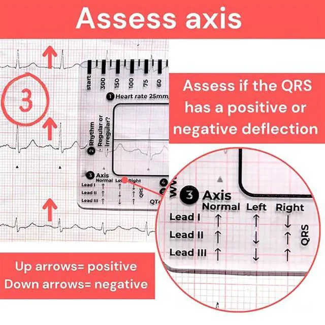 Alt view image 4 of 7 - 1Pc ECG 7 Step Ruler for ECG/EKG Interpretation, EKG Ruler Plastic Measuring Tool, Transparent Calipers Measuring Tool Follow a 7 Plan