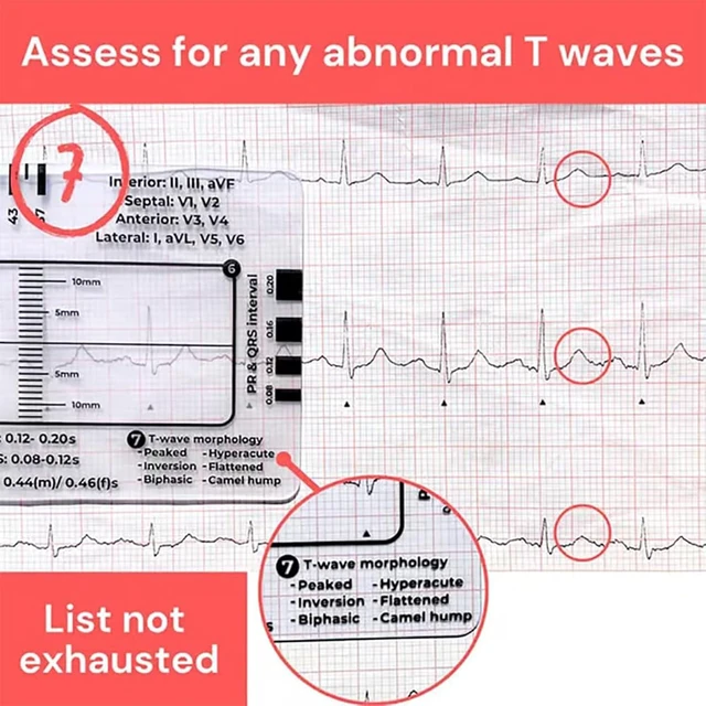 Alt view image 7 of 7 - 1Pc ECG 7 Step Ruler for ECG/EKG Interpretation, EKG Ruler Plastic Measuring Tool, Transparent Calipers Measuring Tool Follow a 7 Plan