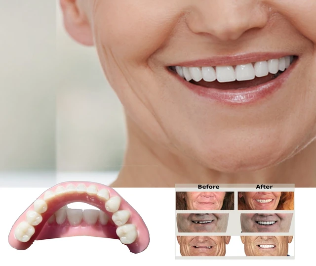 Alt view image 7 of 7 - Dentures DIY Kit, Easy-to-Make Partial Full Fake Teeth, Natural | DIY Kit for Women and Men, All Parts Included. Upper and Lower Pieces. Multi-Color Material. Spares to Remake False Teeth.