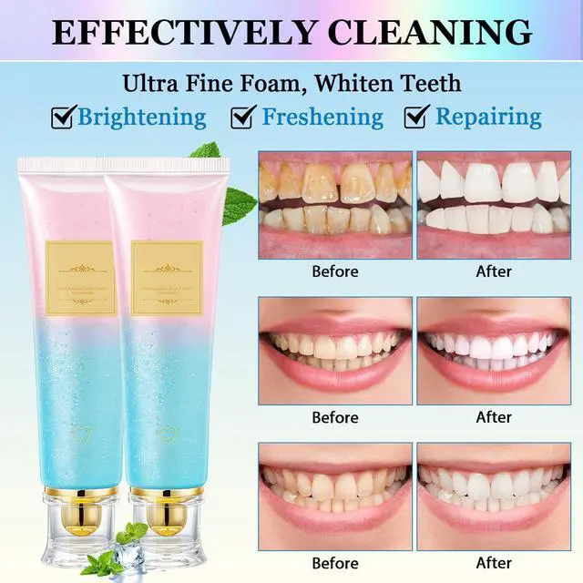 Alt view image 5 of 7 - 2Pcs Acssart Radiant Whitening Toothpaste,Niacinamide Whitening Toothpaste,Easilyous Bright Whiteing toothpastes,Nicotinamide Dazzling White,Removal Tooth Stains,Fresh Breath