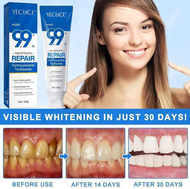 Alt view image 6 of 7 - 9.9% Hydroxyapatite Toothpaste for Enamel Repair and Tooth Strengthening, Nano Hydroxyapatite Remineralizing Toothpaste, Fluoride Free Gentle Whitening Tooth Paste for Sensitive Teeth, Fresh Mint