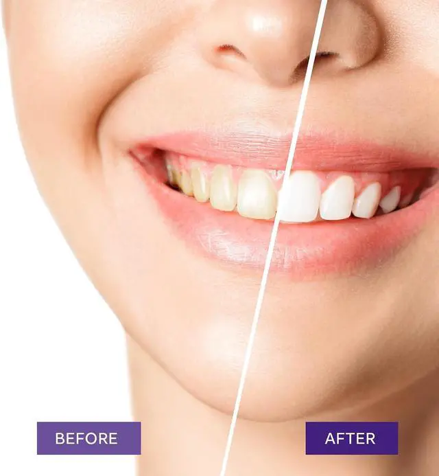 Alt view image 3 of 4 - Purple Teeth Whitening Toothpaste: Teeth Whitening Purple for Adults Unflavored 2-2 Fl Oz