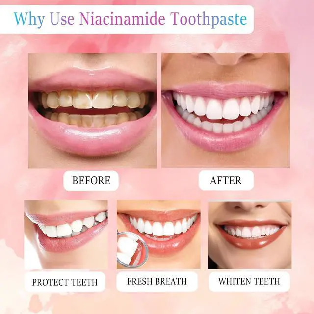 Alt view image 7 of 7 - Niacinamide Whitening Toothpaste, Triple White Probiotic Whitening Toothpaste, Fluoride-Free| Sensitivity Relief | Fresh Breath & Stain Removal Formula | Sakura Peach Fragrance (1)