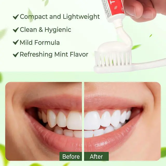 Alt view image 3 of 7 - Travel Toothpaste Bulk, Mint Flavor, 10g/0.35oz (30-Pack) | Disposable Toothpaste, Suitable For Hotels, Camping, Guests, Homeless Individuals, And Charities