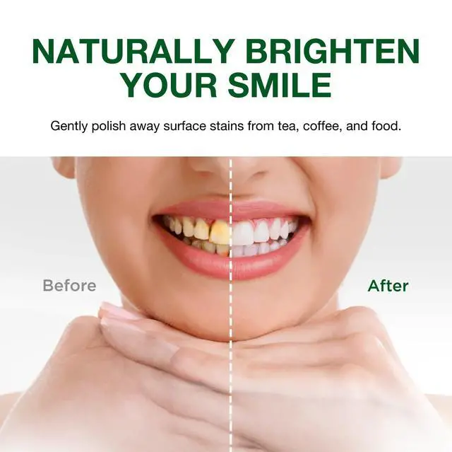 Alt view image 6 of 7 - Sri Sri Tattva Charcoal Toothpaste Gel - SLS, Fluoride Free Herbal Toothpaste with Neem & Ayurvedic Herbs - Natural Teeth Whitening, Fresh Breath, Oral & Gum Health 100g Tube (Pack of 1)