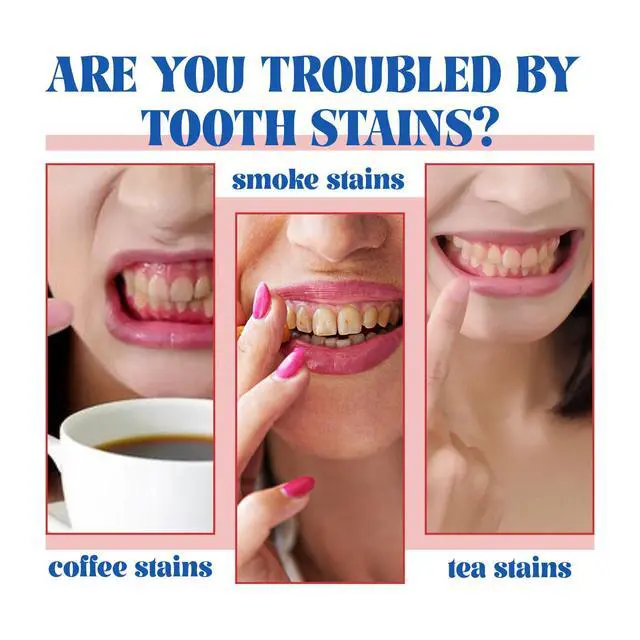 Alt view image 4 of 7 - SP-6 Probiotic Toothpaste,Deep Cleaning Remineralizing Gum Health Care Fresh Breath SP 6 Probiotic Ultra Whitening Toothpaste (1 Pcs)