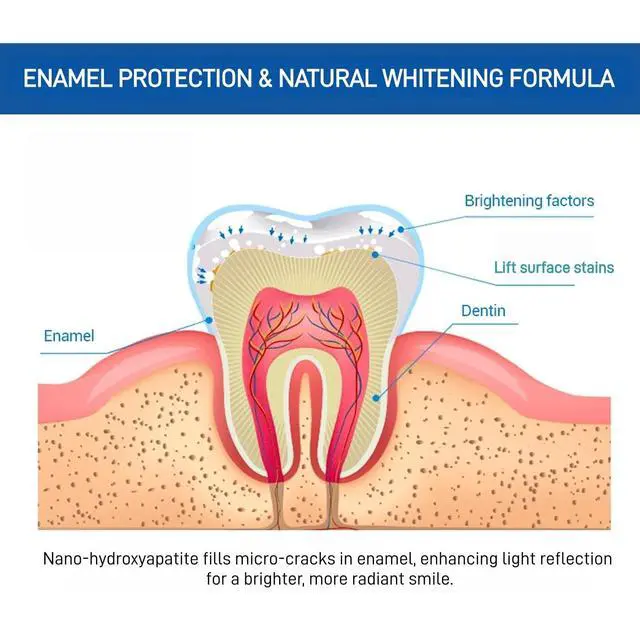 Alt view image 5 of 7 - 1Pcs 10% Nano Hydroxyapatite Toothpaste, Fluoride-Free Formula for Enamel Support & Gentle Sensitivity Care, Natural Whitening, Peppermint Flavor, 120g