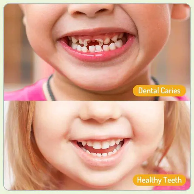 Alt view image 3 of 7 - Kids Oral Spray, Toddler Toothpaste Helper for Daily Oral Care and Fresh Breath, Kid's Mouth Spray with Fluoride Free for Newborn to Preschoolers (40ml*1, Strawberry)