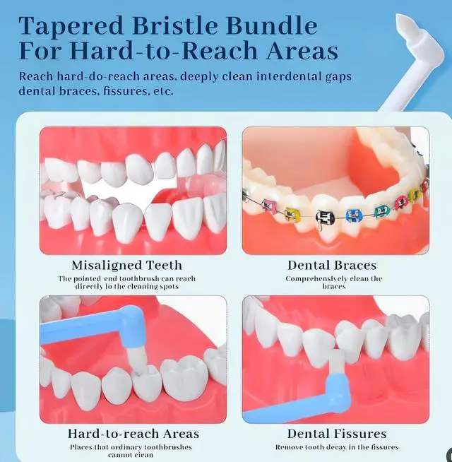 Alt view image 5 of 6 - 8 Pcs End Tuft Toothbrush ,2 types Small Head Tiny Interdental Interspace Toothbrushes brush Single Compact Orthodontic Toothbrush for Braces Detail for Detail Cleaning,Single Compact Brush Adult,kid
