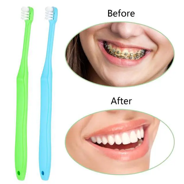 Alt view image 4 of 7 - 2 Pieces Tuft Toothbrush Small Head End Tapered Interdental Interspace Nursing Soft Tiny Toothbrush Orthodontic Periodontal Dental Products(Blue + Green)