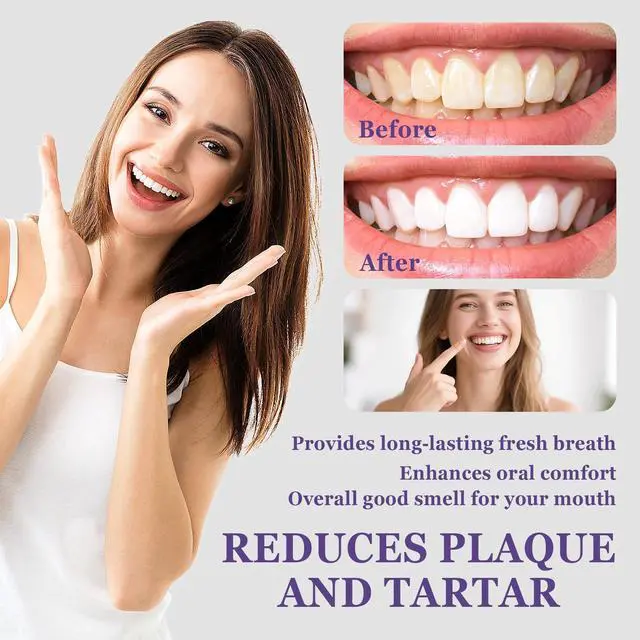 Alt view image 4 of 7 - Oral Breath Spray, Fruit Flavor Mouth Spray Breath Freshener Oral Care, Portable Long Lasting Refreshing Mouth Spray 01