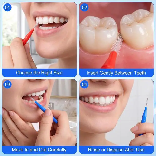 Alt view image 4 of 7 - 100 Pcs Interdental Brushes for Braces, Braces Brush for Cleaner | Toothpicks Soft Dental Floss Picks Teeth Cleaning Tools Braces Cleanerfor Teeth Oral Cleaning(Red,Blue)
