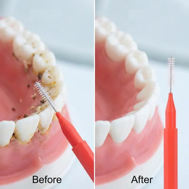 Alt view image 6 of 7 - 100 Pcs Interdental Brushes, 6 Sizes Braces Flossers for Cleaner | Braces Brush Soft Dental Brushes Toothpicks Dental Floss Picks Dental for Braces Oral Cleaning(10 Colors)