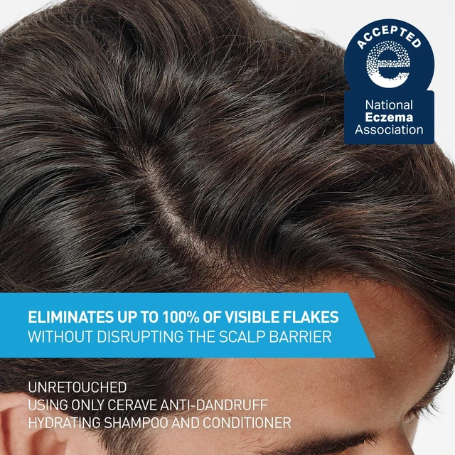 Alt view image 2 of 7 - Hydrating Anti Dandruff Shampoo, Itchy Scalp Treatment, 12oz | Helps Eliminate Flakes with 1% Pyrithione Zinc, Hyaluronic Acid, Niacinamide and Ceramides In A Sulfate Free Formula
