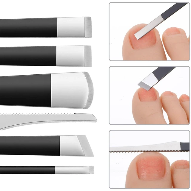 Alt view image 3 of 7 - 6 PCS Pedicure Knife Set, Ingrown Toenail Removal Kit Stainless Steel Removal Pedicure Scraper with Storage Box Professional Foot Scraper Callus Shaver Foot Care for Dead Dry Hard Cracked Skin