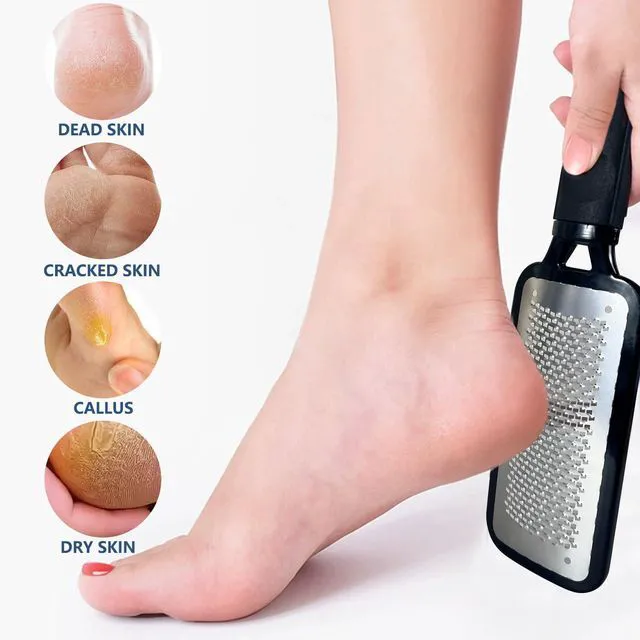 Alt view image 5 of 6 - Foot File Callus Remover Foot Rasp Pedicure Scrubber Tool for Feet Care Stainless Scraper Cracked Dead Skin Remover