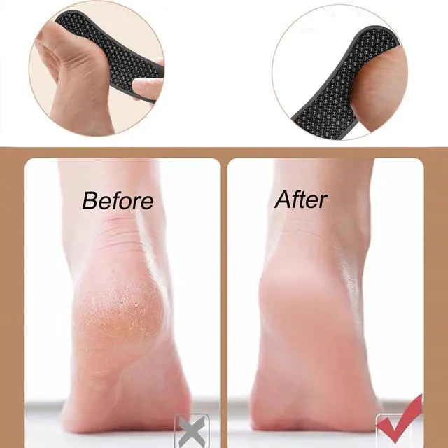 Alt view image 3 of 7 - Nano Glass Foot File,Foot Callus Remover Hard Skin Remover for Feet with Handle Foot File Callus Remover with Nano-Level Grinding Points Durable Foot Scrubber Dead Skin Removal for Wet Dry (Black)
