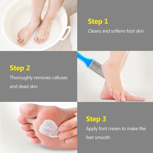 Alt view image 4 of 7 - 4 Pcs Pedicure Foot Files Callus Remover with Double Sided Feet Rasp for Dead Skin - Professional Foot Care Tools to Removes Hard Skin Corns for Dry and Wet Feet