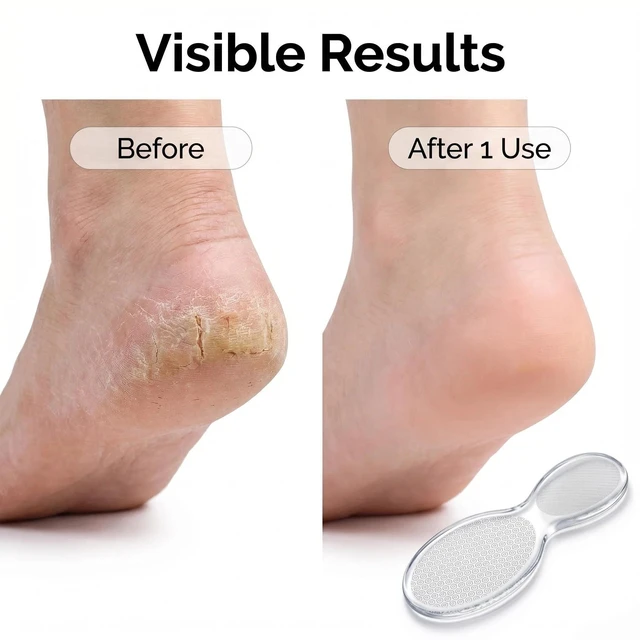 Alt view image 4 of 7 - Nano Glass Foot File Callus Remover 8-Shaped Double Sided Foot Scrubber for Cracked Heels Hard Skin, Coarse Fine Wet Dry Pedicure Tool, Professional Dead Skin Remover for Women Men (Beige Transparent)