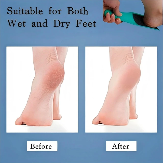 Alt view image 7 of 7 - U-Shaped Curved Foot File Dead Skin Callus Remover Scrubber | Double-Sided, Dead Skin Callus Remover, Foot Scrubber for Wet and Dry Feet, Curved Design for Full Heel & Side Exfoliation