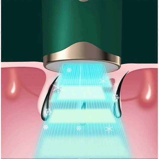 Alt view image 9 of 10 - Ecocleanpath Green Painless Hair Removal Epilator - Home IPL Device with Red & Blue Light, Salon Results