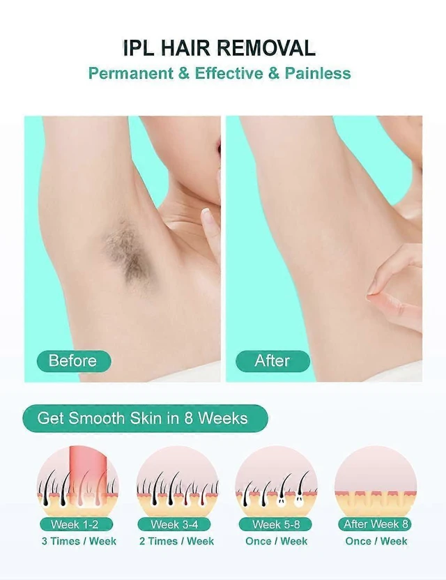 Alt view image 9 of 10 - Ecocleanpath IPL Hair Removal Device for Women & Men - 999,999 Flashes, Painless At-Home Laser for Full Body