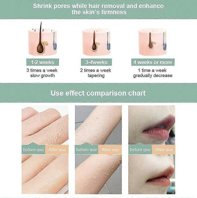 Alt view image 9 of 10 - Ecocleanpath IPL Laser Hair Removal Device for Women & Men, 5 Levels, 999,900 Flashes, LCD Screen
