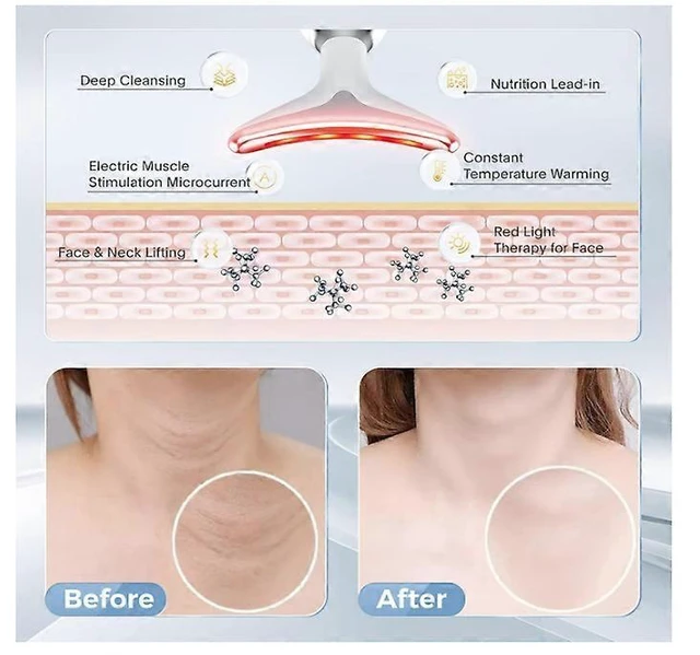 Alt view image 9 of 10 - Ecocleanpath Dolphin 7-in-1 Facial & Neck Massager with Heat & LED Lights, Black
