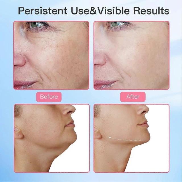 Alt view image 10 of 10 - Ecocleanpath White 7-Color LED Facial & Neck Massager with Heat & Vibration for Anti-Aging Skin Care
