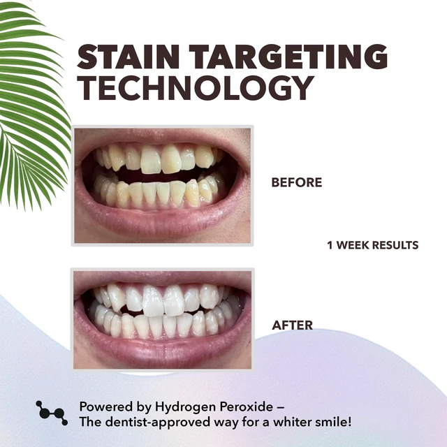 Alt view image 5 of 6 - Purli Teeth Whitening Strips 9-Day Treatment for Sensitive People, Natural Coconut Oil, Gum & Enamel Safe, Dry Strip