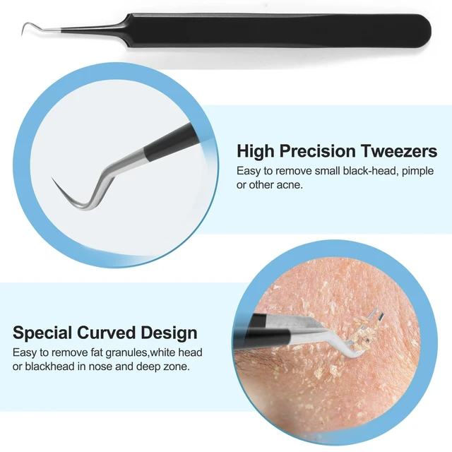 Alt view image 7 of 7 - Blackhead Remover Tools Pimple Popper Tool Kit, Comedones Extractor Acne Removal Kit for Blemish, Black Head Remover for face Risk Free Treatment for Whitehead Popping