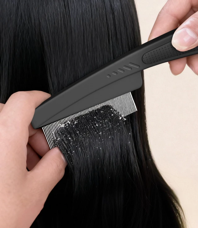 Alt view image 2 of 7 - Dandruff Comb Removal 0.5mm Metal Fine Tooth Scalp Detox Hair Care Tool 1PC |Build Up Flakes Lice Comb, Stainless Steel Teeth, Self Cleaning, Scalp Massage, Anti Slip Handle, for Women Men Kids, Black