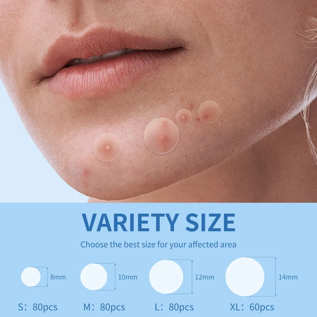 Alt view image 3 of 7 - Pimple Patches for Face, 4 Size 300 Counts Hydrocolloid Acne Patches | Pimple Patches for Covering Zits and Blemishes, Spot Stickers with Salicylic Acid, Tea Tree Oil & Calendula Oil