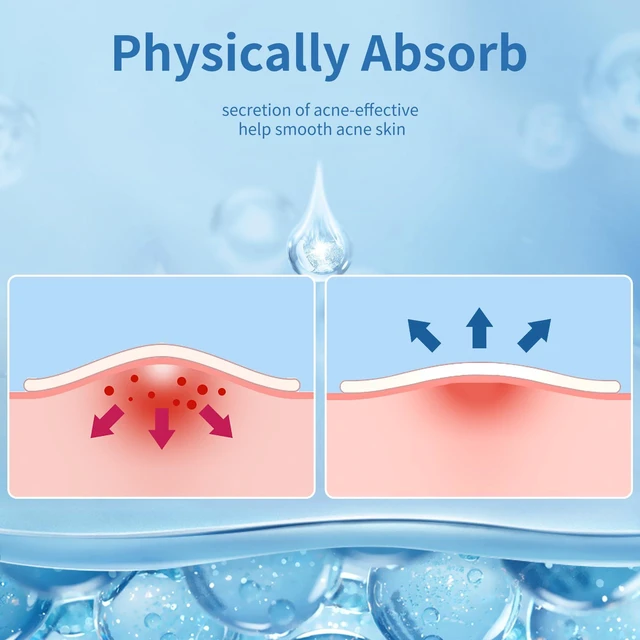 Alt view image 6 of 7 - Pimple Patches for Face, 4 Size 300 Counts Hydrocolloid Acne Patches | Pimple Patches for Covering Zits and Blemishes, Spot Stickers with Salicylic Acid, Tea Tree Oil & Calendula Oil