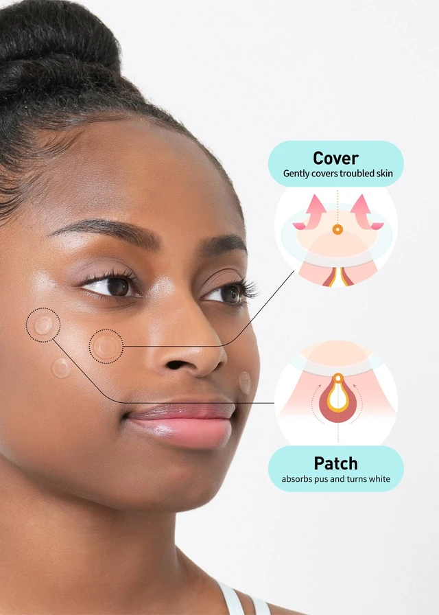 Alt view image 3 of 6 - Care Plus Spot Patch | Hydrocolloid Acne Korean Spot Patch to Cover Zits, Pimples and Blemishes, for Troubled Skin and Face (Hydrocolloid, 306 Count (Pack of 3))
