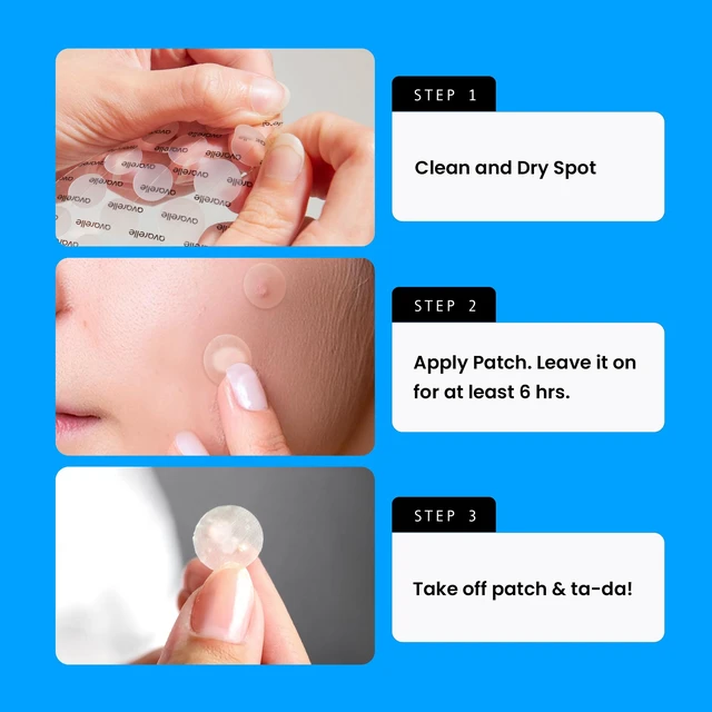 Alt view image 7 of 7 - Original Hydrocolloid Acne Cover Patches Zit Stickers 80 Count | Acne Cover Patches for Face, Zit Stickers, Hydrocolloid Dots, Blemish Patches, Tea Tree, Cica, Calendula, Vegan