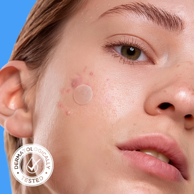 Alt view image 3 of 7 - Original Hydrocolloid Acne Cover Patches Zit Stickers 80 Count | Acne Cover Patches for Face, Zit Stickers, Hydrocolloid Dots, Blemish Patches, Tea Tree, Cica, Calendula, Vegan