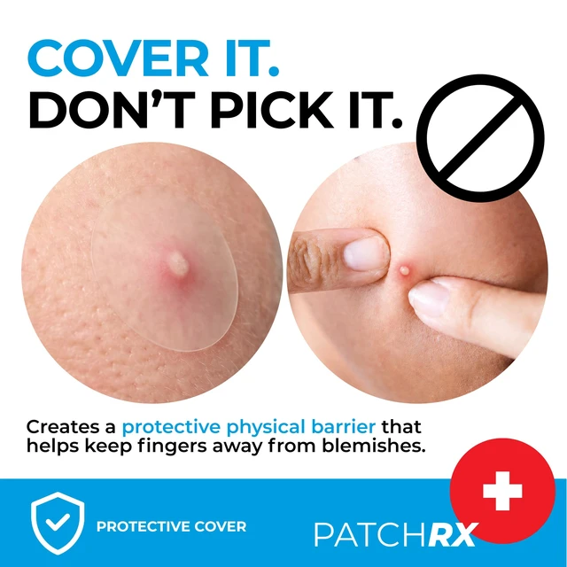 Alt view image 5 of 7 - Pimple Patches for Face (120 Patches), Hydrocolloid Acne Patches with Tea Tree Oil, Pimple Patch Pimple Stickers - Hydrocolloid Patch Acne Dots - Acne Pimple Patches For Face - Zit Patches