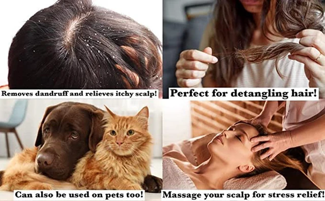 Alt view image 5 of 7 - Scalp Massager Shampoo Brush Pack of 2 Scalp Scrubber for Dandruff Removal, Exfoliating Hair Brush, Wet & Dry for All Hair Types