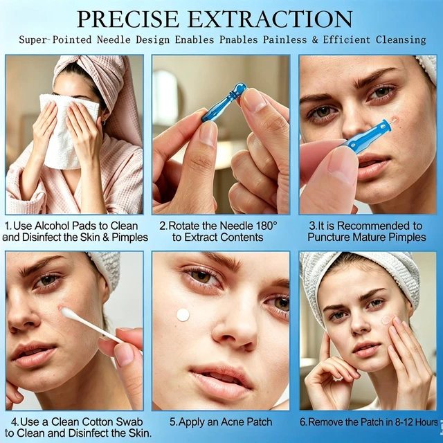Alt view image 5 of 6 - 60PCS Pimple Popper Kit with 72 Acne Patches, Disposable Blemish Tool for Whitehead, Blackhead, Pimple Clearing, Ultra-Fine 0.3mm Tip for Home/Travel Use (Blue)