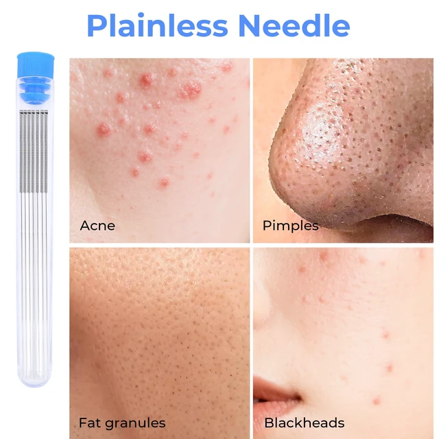 Alt view image 2 of 5 - Disposable Pimple Needles, Acne Needle, Effective Blackhead and Blemish Remover Tools, Pimple Popper Tools for Clear Tool (50 PC)
