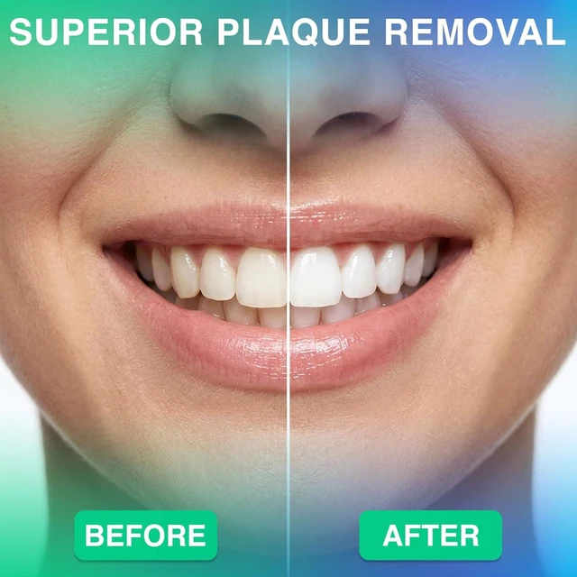 Alt view image 7 of 7 - Professional Water Flosser - Advanced Dental Care for a Healthier Mouth, Gum, and Teeth - IPX7 Waterproof Oral Irrigator