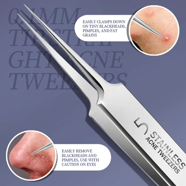 Alt view image 6 of 7 - Teenitor 7 Pcs Pimple Popper Tool Kit, Surgical Grade Blackhead Remover Tools, Ingrown Hair Tweezers, Blackhead Extractor Pimple Extractor, Black Head Remover