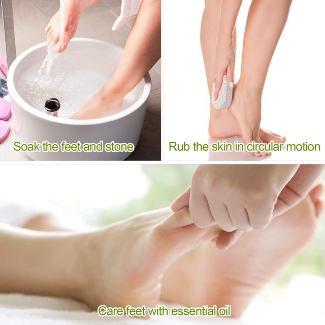 Alt view image 2 of 7 - 2PCS Natural Pumice Stone, Asqraqo Lava Pedicure Tools Hard Skin Callus Remover for Feet and Hands - Foot File Exfoliation to Remove Dead Skin, and Callusess