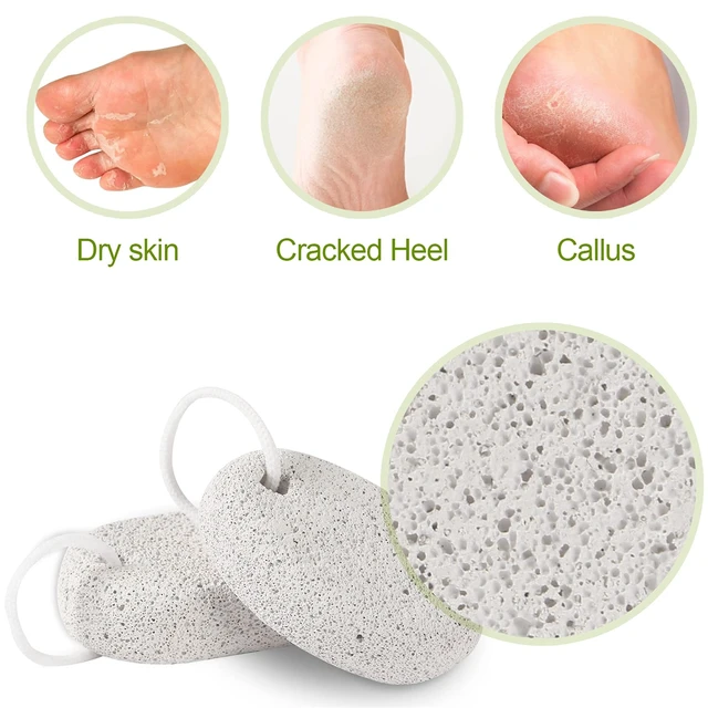 Alt view image 6 of 7 - 2PCS Natural Pumice Stone, Asqraqo Lava Pedicure Tools Hard Skin Callus Remover for Feet and Hands - Foot File Exfoliation to Remove Dead Skin, and Callusess
