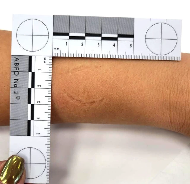 Alt view image 3 of 3 - Photomacrographic Scale (No.2-Metric)