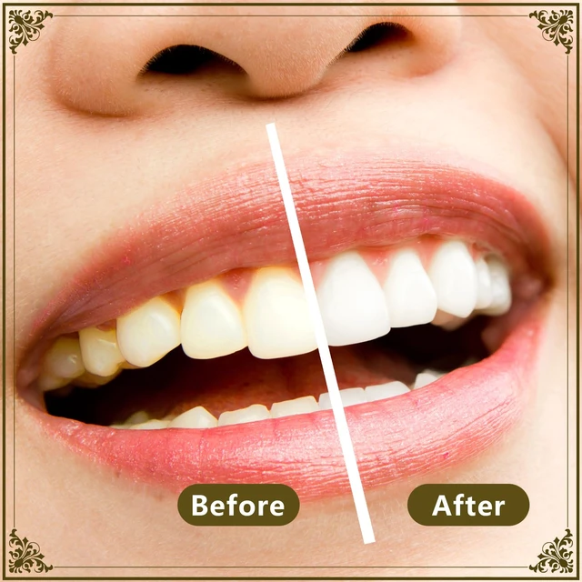 Alt view image 5 of 6 - Miswak (Sewak) Sticks Pack of 2 - Vacuum Sealed Traditional Natural Toothbrush for Healthy Teeth, Gums and Fresh Breath