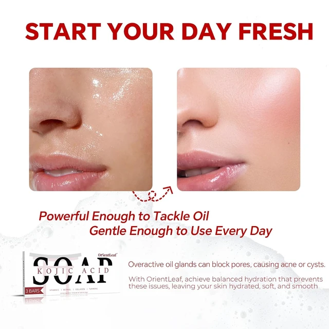 Alt view image 3 of 6 - ORIENTLEAF Kojic Acid Soap & Turmeric Soap Bar 3 Pack for Dark Spots