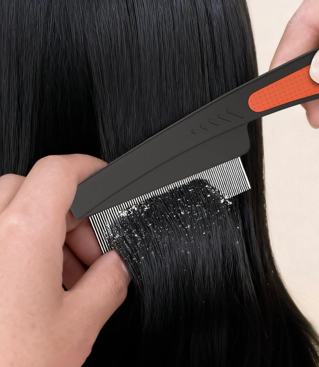 Alt view image 3 of 6 - Dandruff Comb Removal 2PC Hollow Fine Tooth Scalp Detox Hair Care Tool