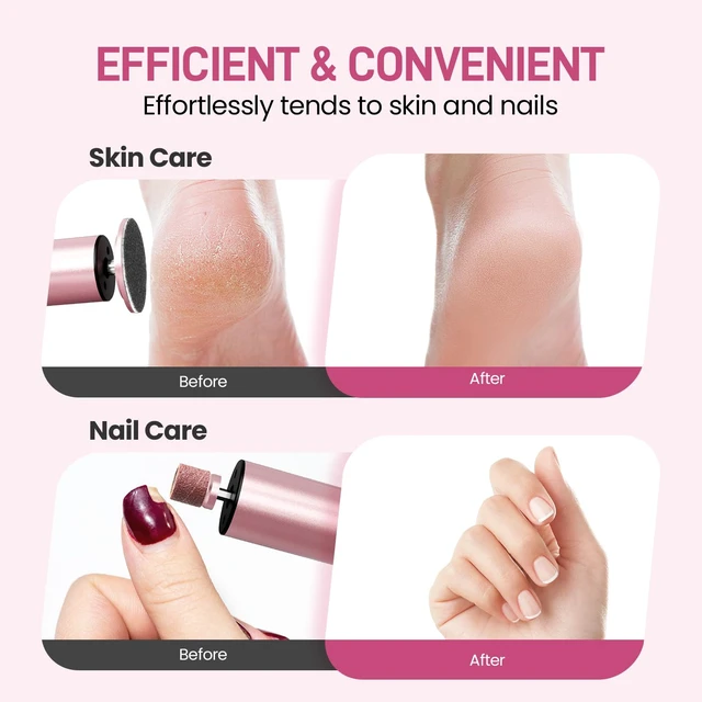 Alt view image 5 of 7 - 2-in-1 Electric Foot Callus Remover, Self Care Gifts for Women Mom Lover | Professional Pedicure Tool for Feet | 2 Hours Operation | 6 Gears Adjustable Foot File | 1200mAh Rechargeable | 20 Sandpapers